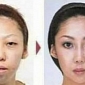 Husband Suing Wife for Giving Him Ugly Child, Having Plastic Surgery, Wins Case
