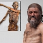 Iceman Ötzi Had Lyme Disease