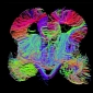 In-Utero Map of the Human Brain Hints at the Origins of Autism