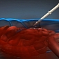 Injectable Foam Stops Internal Bleeding by Expanding Inside the Body