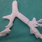Innovative 3-D Printed Device Saves Baby's Life