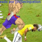 James Rodriguez's Website Defaced with Neymar Injury Meme