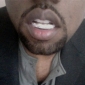 Kanye West Gets Diamond Teeth: I Think They’re Cooler