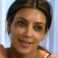 Kim Kardashian Left with Bruised Eyes from Botox