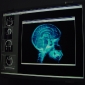 LG.Philips Helps Doctors Take a Better Look Inside Your Head