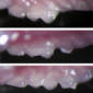 Lab Mice Get New Teeth Through Genetic Effort