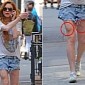 Lindsay Lohan Injures Leg in New York City Bike Ride – Photo