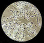 Lubricants Paralyze Sperm Cells
