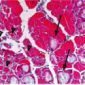 Macrophages Play Huge Role in Injured-Muscle Regeneration
