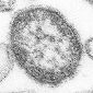 Measles' Mechanism of Infection Deciphered
