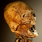 Mummified Head Identified as Henry IV's May Not Belong to the French King After All