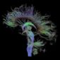 Neural 'Stopwatch' Identified in the Human Brain