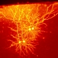 Neural Transplants Can Address Brain Diseases