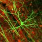 Neuron 'Battle' Decides Where or Whether You Look