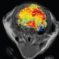 New Brain Tumor-Viewing Method Uses Nanoparticles