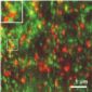 New Cell Adhesion Mechanism Discovered