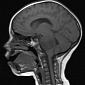 New Compound Diagnoses and Treats Brain Tumors