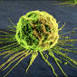 New Enzyme Holds Promise in Fighting Aggressive Breast Cancer