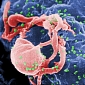 New Toxin Kills Persistent HIV-Infected Cells