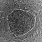 New Type of Airway Stem Cell Identified
