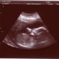 New Ultrasound Imaging Method to Become Available Soon