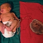 New Umbilical Cord Trend: Parents Leave Babies Attached to Their Placentas