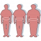 Organs from Obese Donors Increase Risks for Recipients