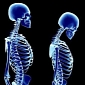 Overweight and Obese People Are More Likely to Develop Osteoporosis