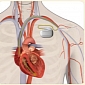 Pacemaker Gets Electricity from the Heart, Needs No Batteries