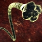 Parasitic Meningitis Hits 12-Year-Old Girl from Benton, Arkansas