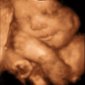 Parents-to-be Can Watch 3-D Ultrasound Movies of the Fetus in the Womb