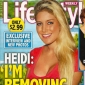 Plastic Surgery Ruined My Marriage and My Life, Says Heidi Montag