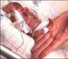 Premature Births Mean Less Fertile Individuals