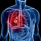 Researchers Figure Out How Lung Cancer Spreads Through the Body