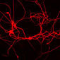 Researchers Make Neurons from Skin Cells