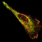 Researchers Photograph RNA Molecules Inside Living Cells