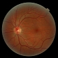 Retina Cells Can Now Be Printed to Cure Blindness