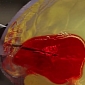Robots Can Perform Brain Surgeries on Fatal Blood Clots – Video