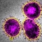 Sars-like Virus Makes Its First Victim in the UK