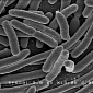 Scientists Decode Killer Strain of E. coli