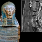 Second-Oldest Case of Prostate Cancer Found in Mummy