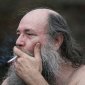 Smoking Causes Baldness in Men!
