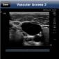 SonoAccess App Offers Ultrasound Resources for Medical Professionals