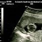 Sonogram Reveals Selena Gomez Pregnant with Justin Bieber's Twins