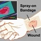 Spray-On Smart Bandages Will Help Heal Burns and Other Injuries