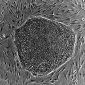 Stem Cell Bandage Enters Clinical Trials