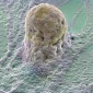 Stem Cell Therapy Moves Closer