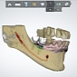 Stratasys 3D Printers Can Now Make You New Teeth