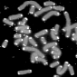 Stressful Environments Shorten Telomeres on Children's Chromosomes