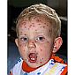 Study: 2 Vaccine Doses Protect Kids from Chickenpox